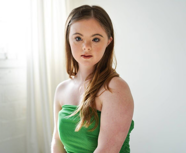 Living with Down syndrome